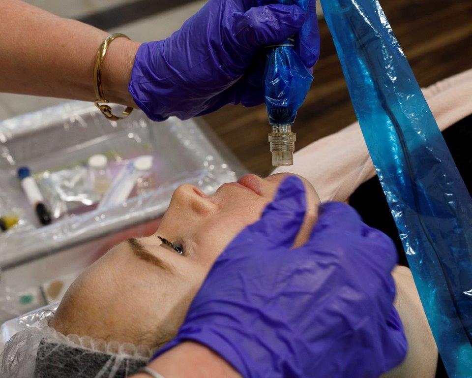 InnoPen pour micro-aiguille / InnoPen for micro-needling